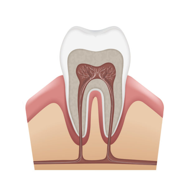 Root Canal_Dentist_New westminster